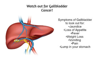 Gallbladder Cancer