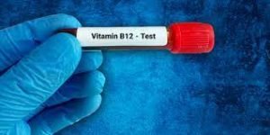 vitamin-b12-blood-test