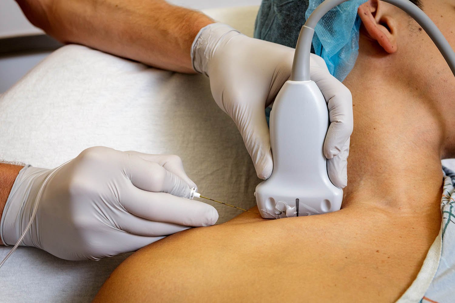 Guided Injection for Chronic Pain Management