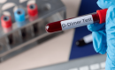 D-Dimer Test