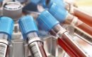 DL2 Blood Test
