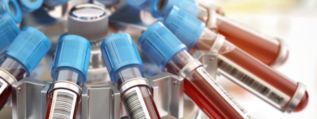 DL2 Blood Test
