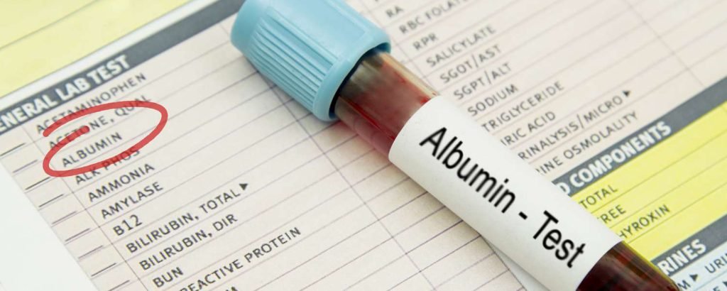 Serum Albumins : Blood Test - Fusion HealthCare