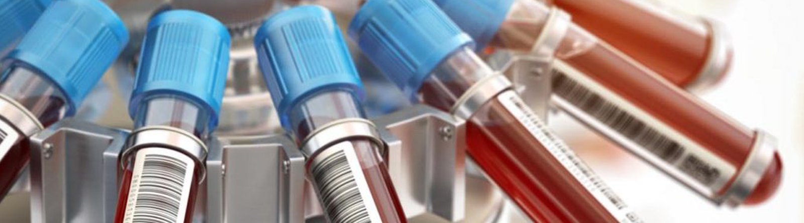 Same day blood test service Fusion HealthCare