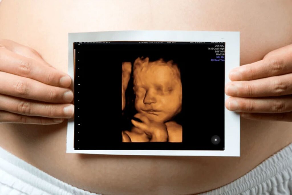 Private 3D/4D Baby scan in Luton: See your baby in greater detail ...