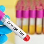 Karyotype blood test